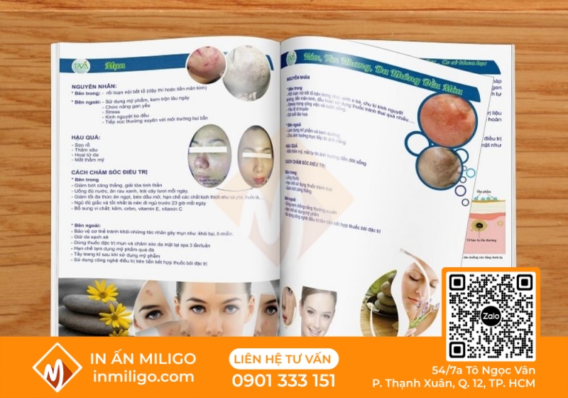in catalogue spa